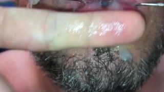 Piss And Cum Facial On My Huge Vanbeek Braces